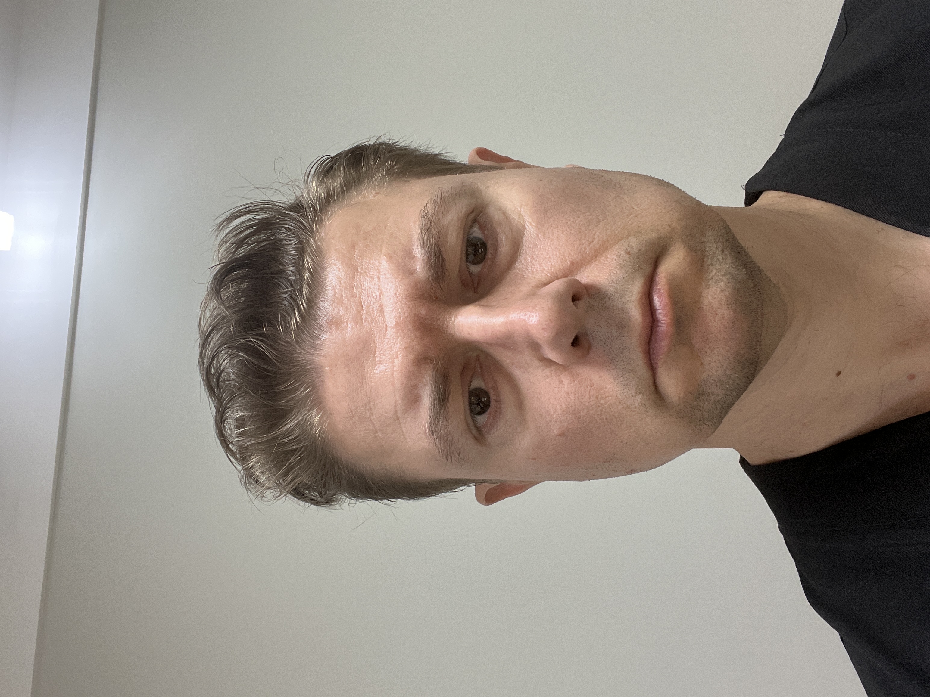 Perito Médico Cirurgião Geral e Cirurgião Vascular, com atuação em Angiorradiologia e Cirurgia Endovascular e Ecografia Vascular com Doppler — Adriano Felipe Groff Funck